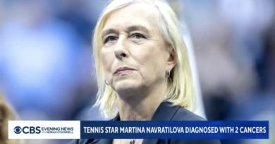 Tennis : Martina Navratilova atteinte d'un double cancer